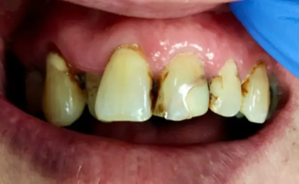 Before - Dr Mehul Shah